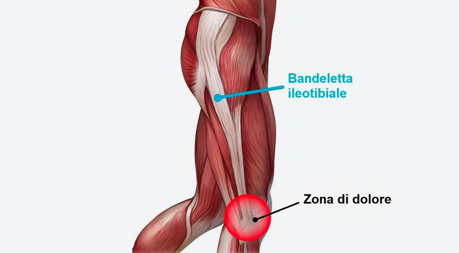 Bandelletta leotibiale